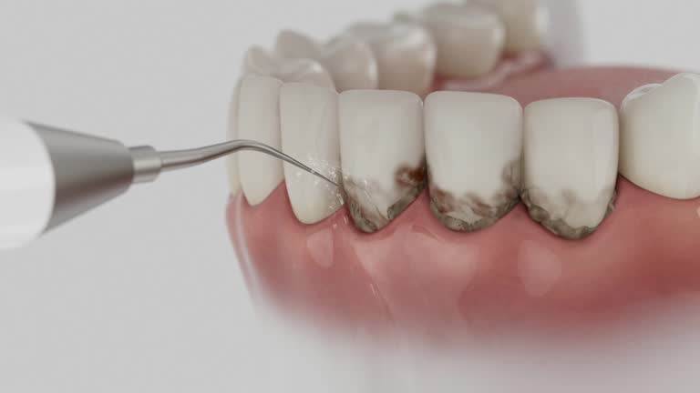 Reliable Tooth Extraction contractor in Millvale, PA by Smile Center Dentistry